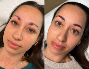 Brow Tattoo Now Available at All Three Skinvae Clinics