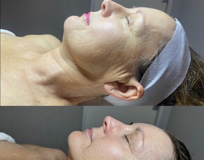 Before &amp; After: Christine
