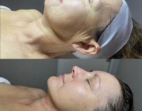 Before &amp; After: Christine