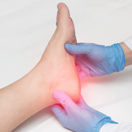 Specialist podiatry and physiotherapy care for heel pain including plantar fasciitis, heel spurs, and children’s heel conditions at Foot Foundation