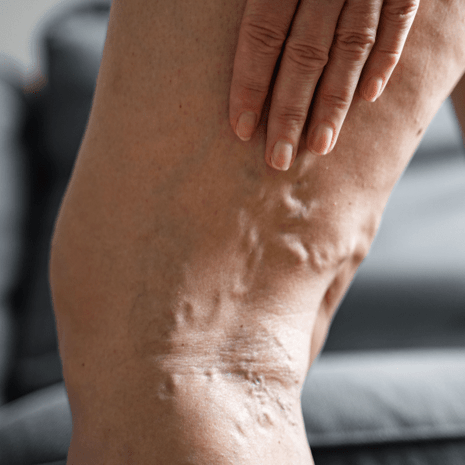 Foot Foundation podiatry care for vascular and circulatory leg issues with Doppler assessment, orthotics, and specialist referral