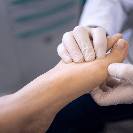 Specialist podiatry care for claw toes with silicone props, orthotics, strengthening, and footwear optimisation at Foot Foundation