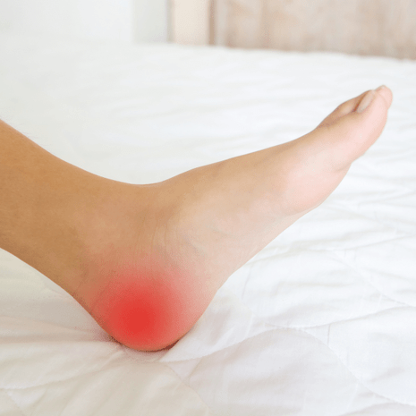 Foot Foundation podiatry treatment for plantar fasciitis with orthotics, shockwave therapy, and rehabilitation for heel pain relief