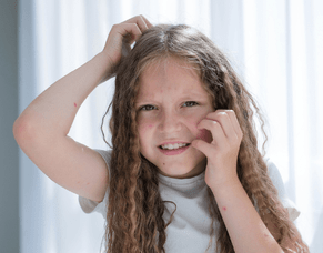 EFFECTIVE OSTEOPATHIC TREATMENT OF SUDDEN ONSET ECZEMA IN A CHILD