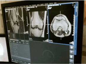 Ageing and Musculoskeletal Health: The Role of Muscle Mass and Strength in Older Adults
