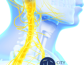 Vagus Nerve Stimulation