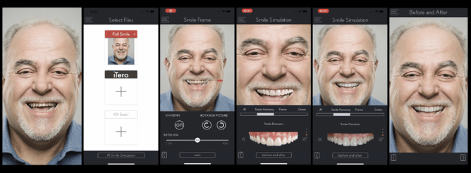 Using AI, the DSD App creates portability and speed to create Smile Simulations