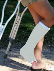 Have you ever broken a bone before?