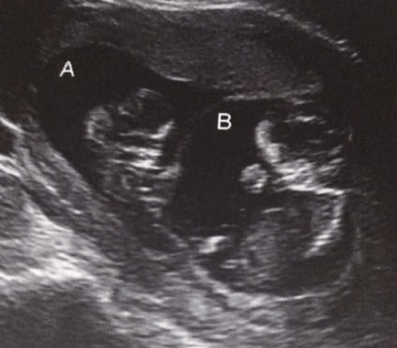 EXPECTANT PARENTS: ANTENATAL CLASSES