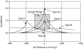 What is tympanometry?
