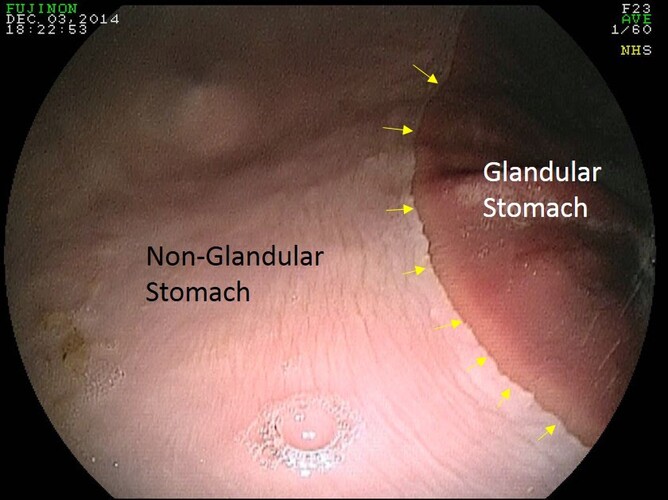 Hind Leg Problems in Horses