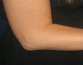 Don&rsquo;t put anything smaller than your elbow in your ear!