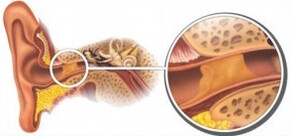 Everything you wanted to know about ear wax