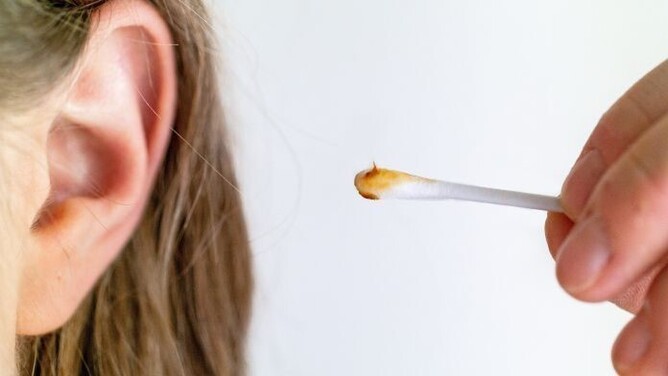 Dos and Don'ts of Treating an Ear Wax Blockage