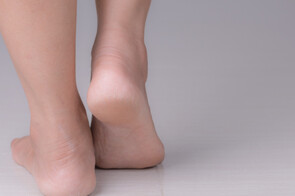 Cracked Heels