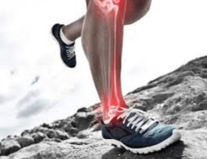 Running Injuries
