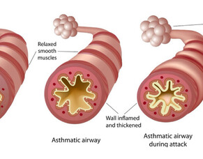 Ditch the blue, try the NEW!