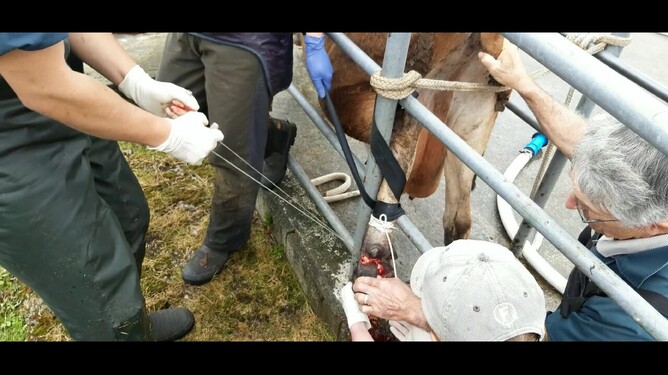 We then introduce wire and saw through the bone to remove the toe.