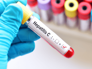 Hepatitis C Testing