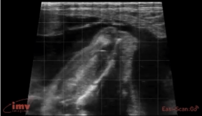 A 120-day-old foetus. Here we can only see the nose of this calf on our screens. We no longer fit even just the head on our screens as they’ve grown so big. This makes taking measurements of the head or body impossible and leads to only rough estimates of ages.