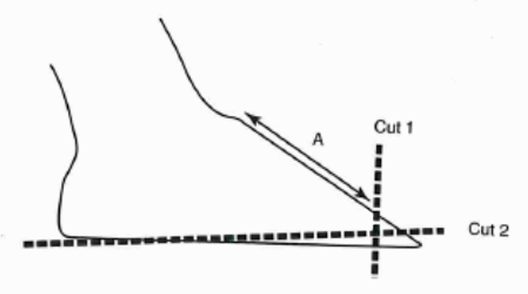   Figure 1. Lines show the cuts that will shorten the toes as described in Step 1 and 2. It also indicates the location for measuring the correct length of toe with the palm of your hand (A) .