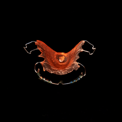 Custom made oral device, transparent red in colour. The palet piece has a central hole surrounder by a raised inner rounded lolly shaped impression to stimulate the wearers tongue to swallow. The retainer plate is fashioned with wire attachments that clip onto teeth. Also a front wire that slips on between the top lip and gums which has eight tiny beads threaded into it to stimulate the wears lip muscles. This oral device is centrally positioned on a square black background.